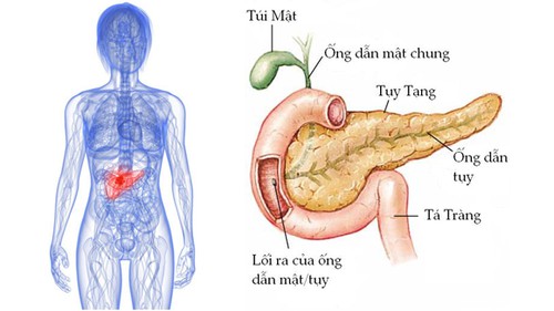 Tìm hiểu thông tin về một số loại sữa cho người ung thư tụy Tìm hiểu thông tin về một số loại sữa cho người ung thư tụy